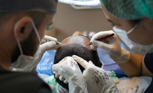 How To Choose The Right Hair Transplant Surgeon For You